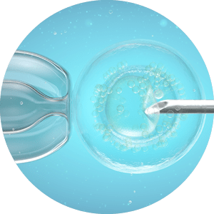 In vitro fertilisation (IVF), computer illustration
